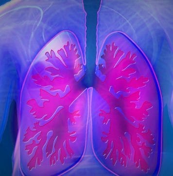 Consenso de Hipertensión Pulmonar