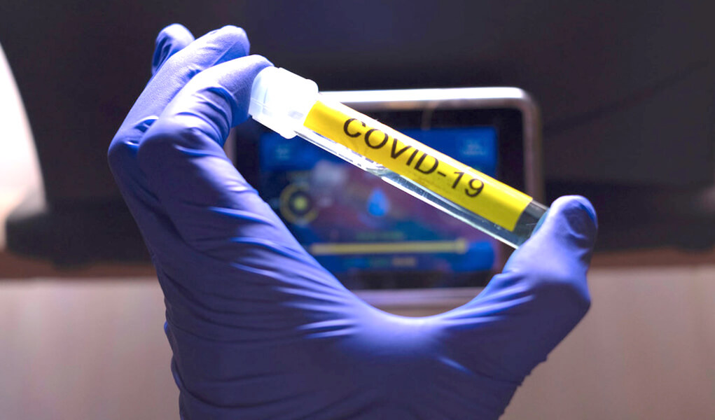 COVID‑19 vacunas y tratamientos