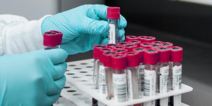 Científica mexicana elimina el virus del papiloma humano